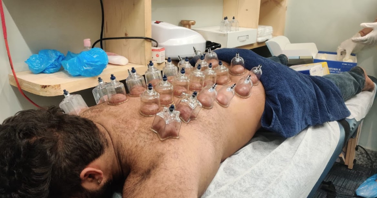 Cupping Therapy Noida